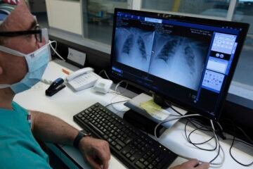 Más de la mitad de las muertes en 2024 fueron causadas por tumores o enfermedades cardiovasculares