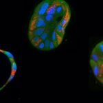 La edición genética ayuda a corregir mutaciones dañinas en el ADN mitocondrial humano