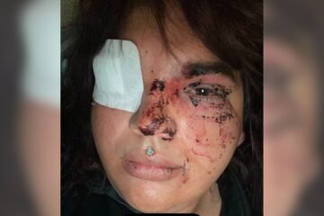 Una mujer trans sufre una paliza por parte de una decena de personas en un pueblo de León