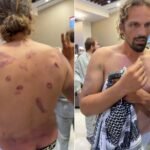 Parte médico de la flotilla: huesos fracturados, heridas de balines y agresiones sexuales