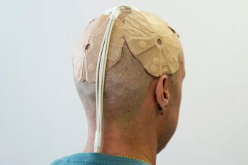 La estrategia experimental que prueba Pablo contra el tumor cerebral más agresivo