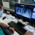 Descubren cómo la leucemia invade los pulmones y una estrategia para evitarlo