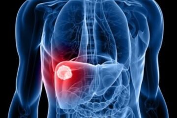 Una investigadora española logra un prometedor avance en cáncer de hígado